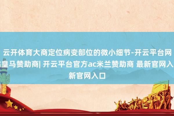 云开体育大商定位病变部位的微小细节-开云平台网站皇马赞助商| 开云平台官方ac米兰赞助商 最新官网入口